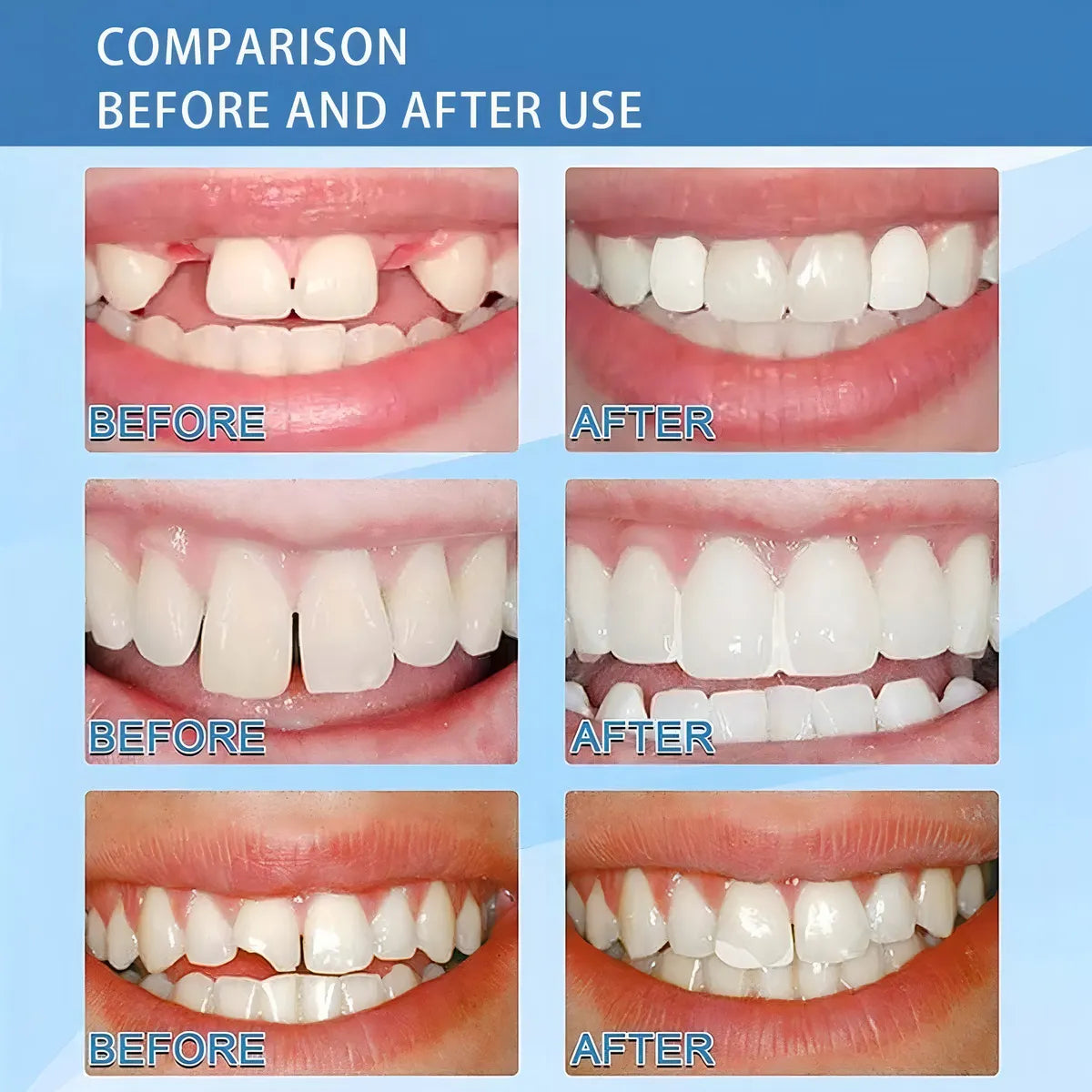 Dentfix™ - Resina Dental