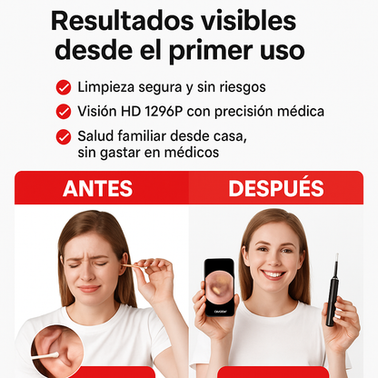 Limapiador de Oídos Pro – con Cámara HD